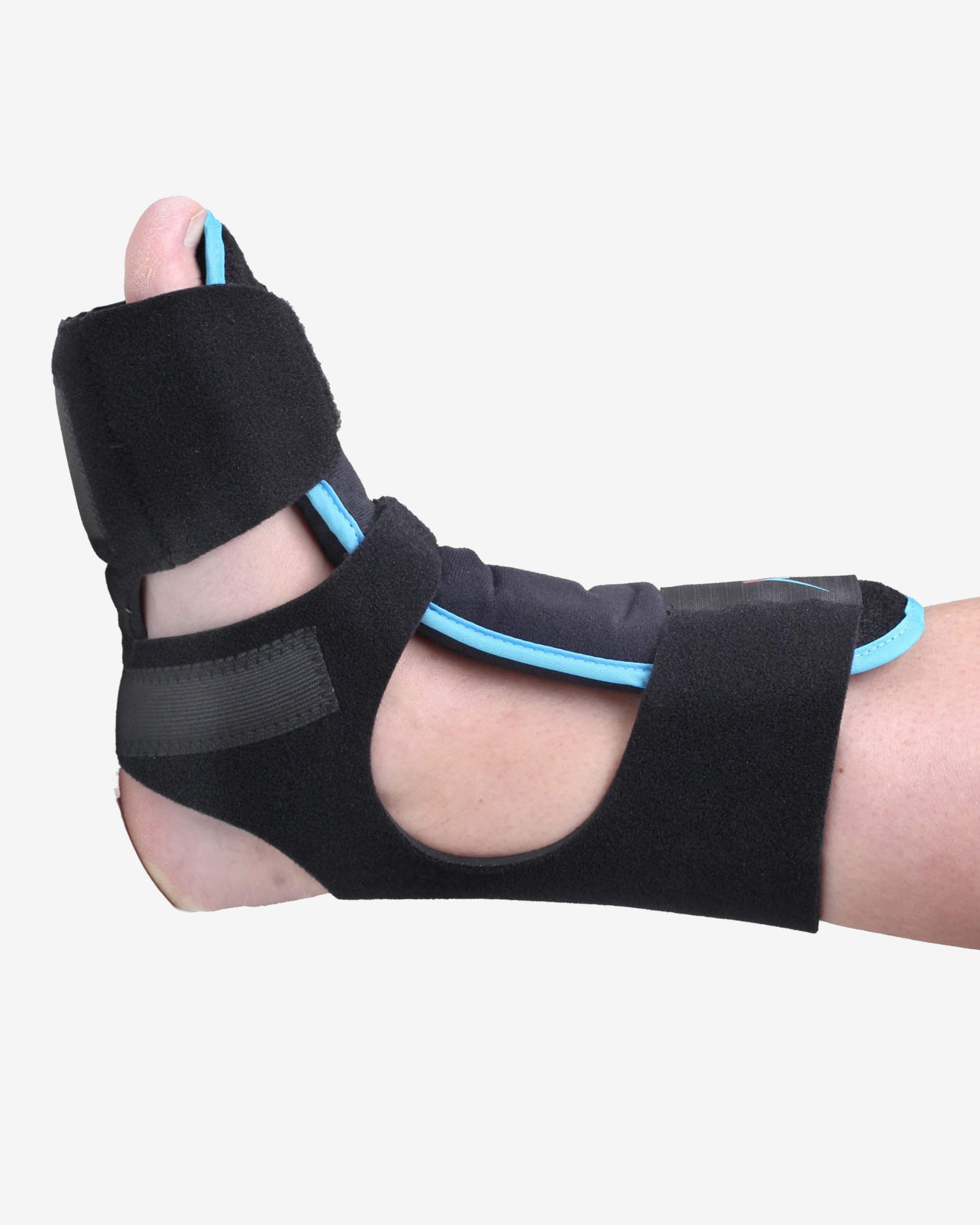 Dorsal Night Splint