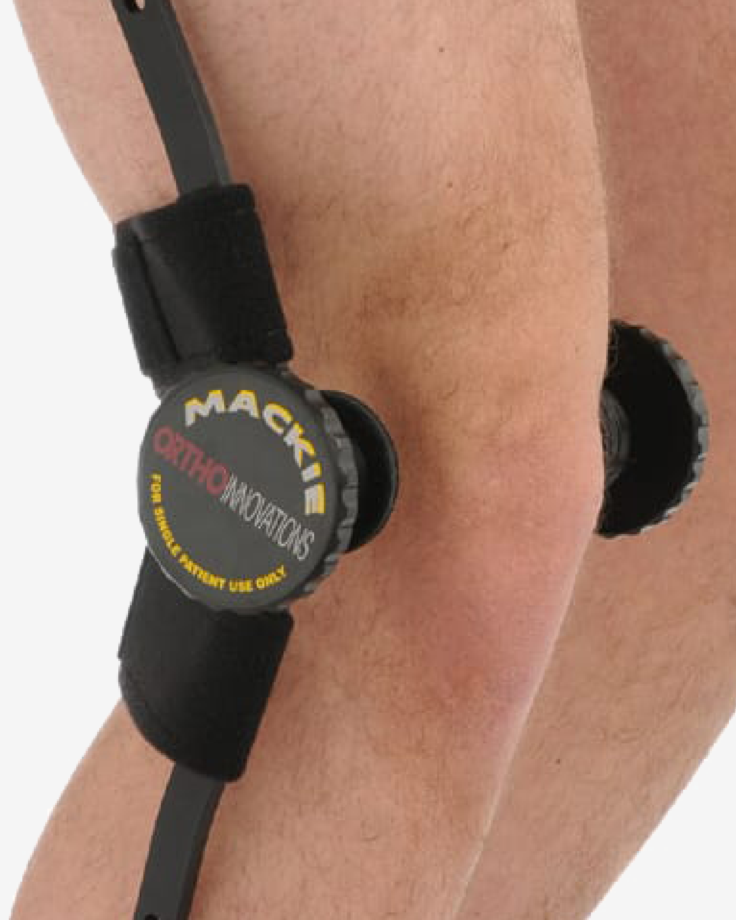 Mackie® Knee Contracture Brace