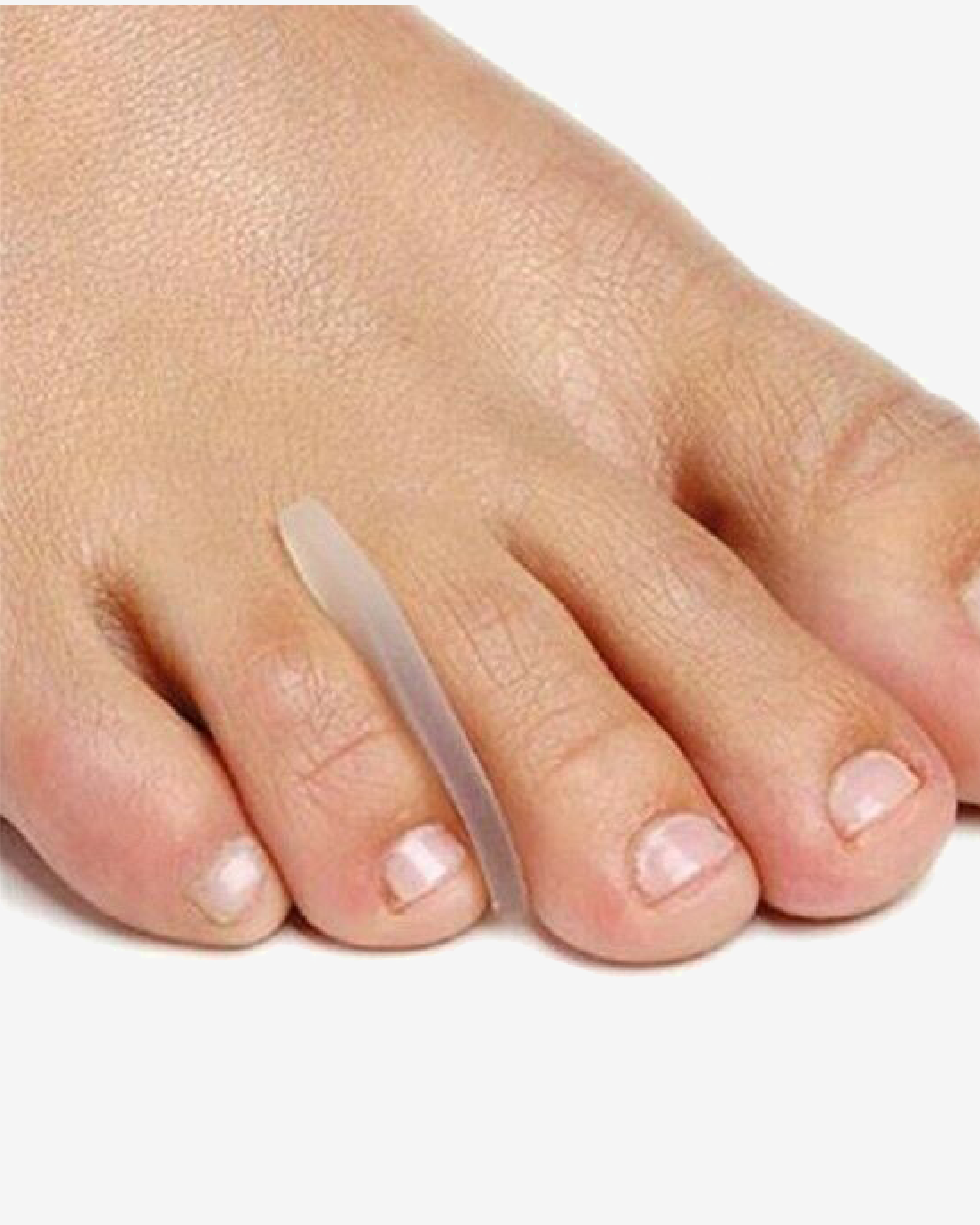 PediGel® Gel Toe Separator (4 Units)