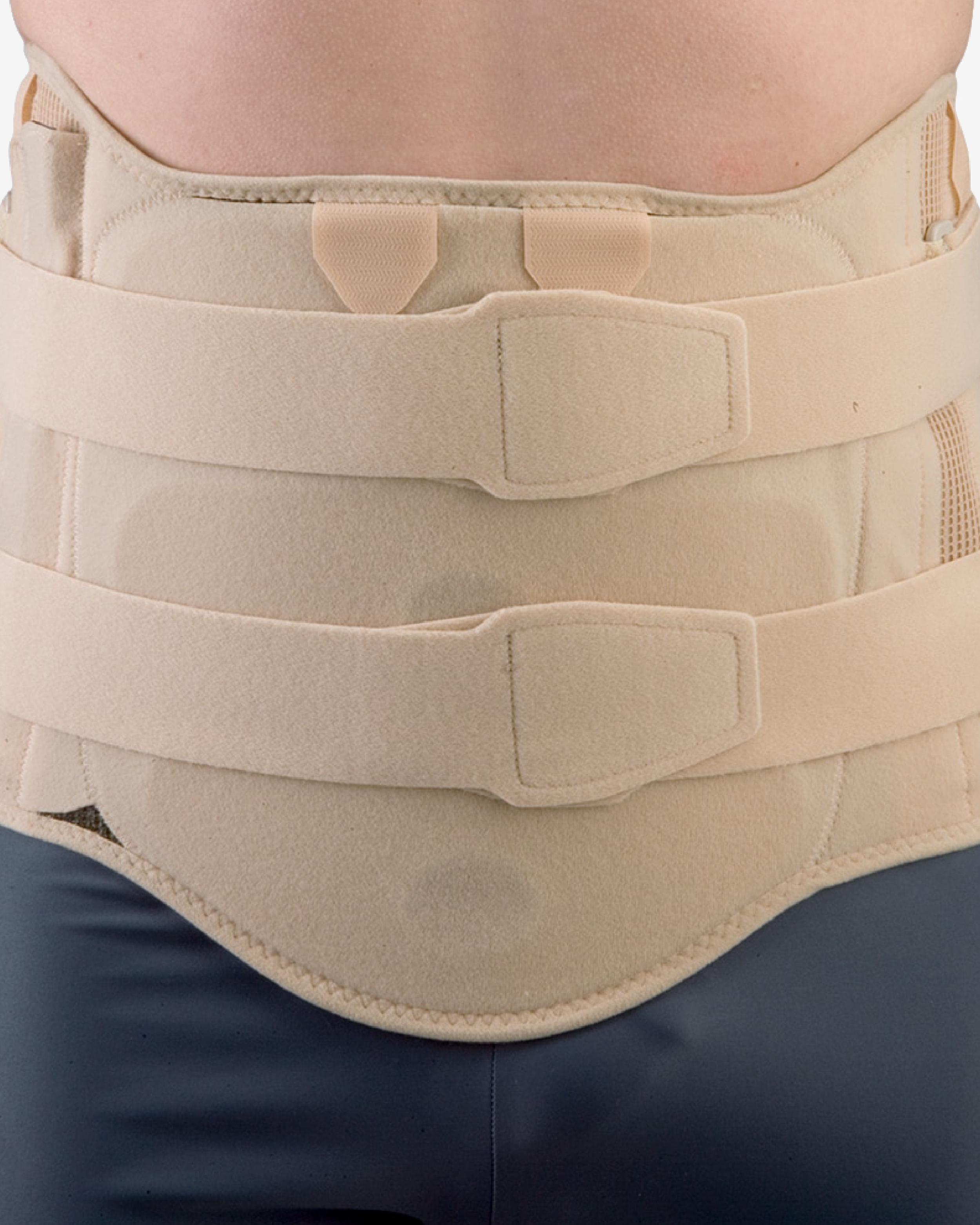 Star Brace® Corset TLSO