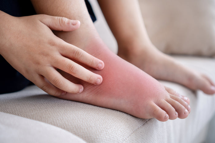 What Footwear Is Suitable for Swollen or Sensitive Feet?