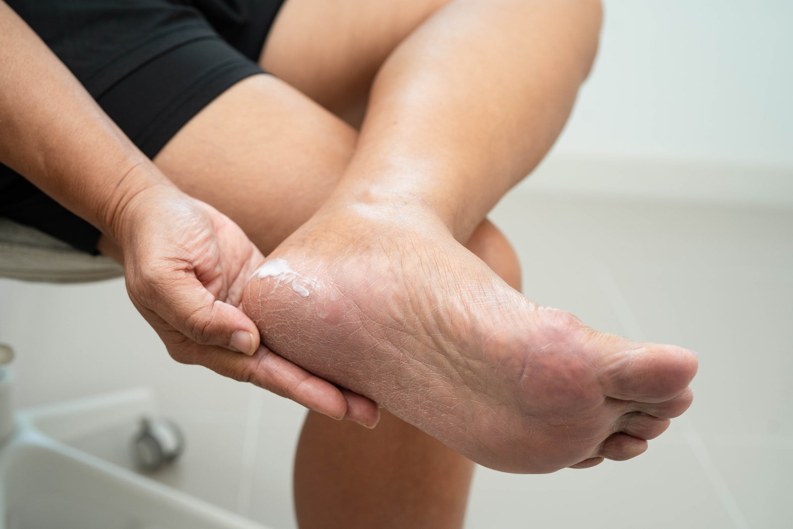 What Should You Check on Your Feet Each Day?