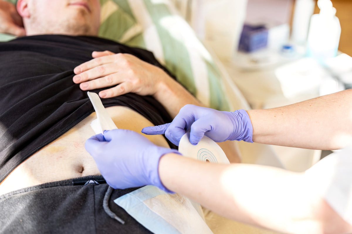 When Should a Stoma, Skin Problem or New Abdominal Bulge Be Professionally Assessed?
