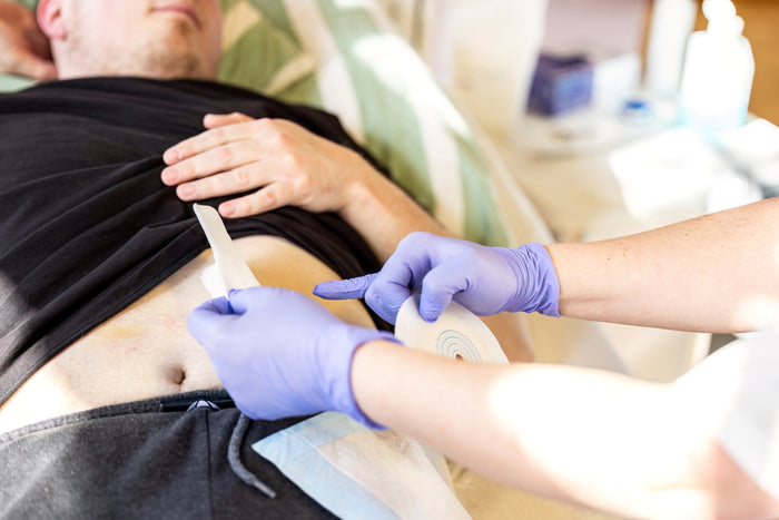 When Should a Stoma, Skin Problem or New Abdominal Bulge Be Professionally Assessed?