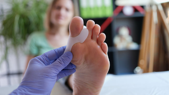 How Should a Bunion Splint Fit?