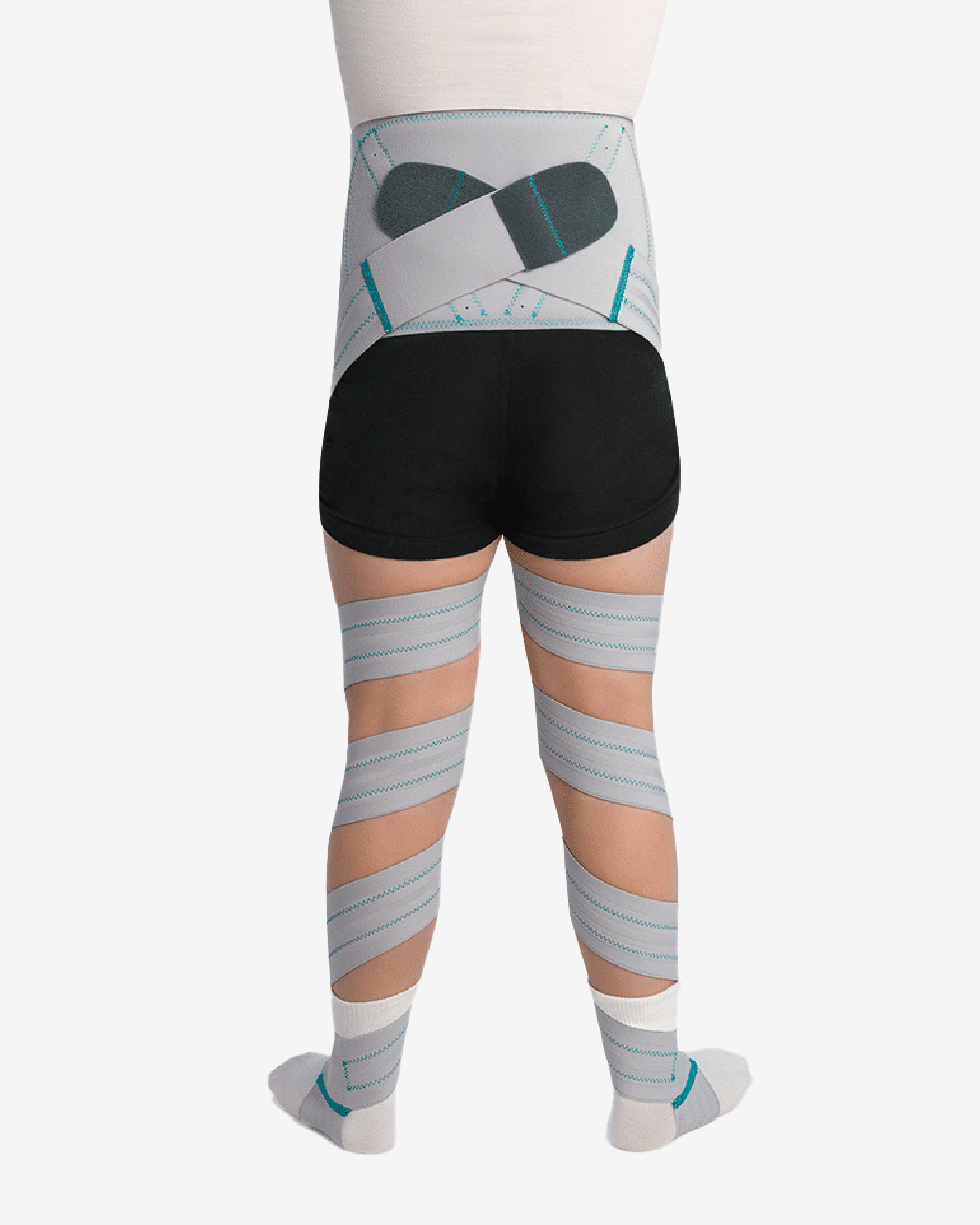 Tibiofemoral De-rotation Orthosis
