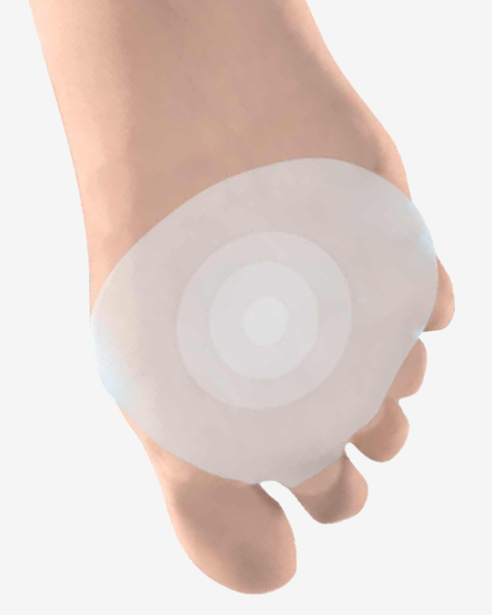 What Is a Gel Metatarsal Pad and Where Should It Sit?