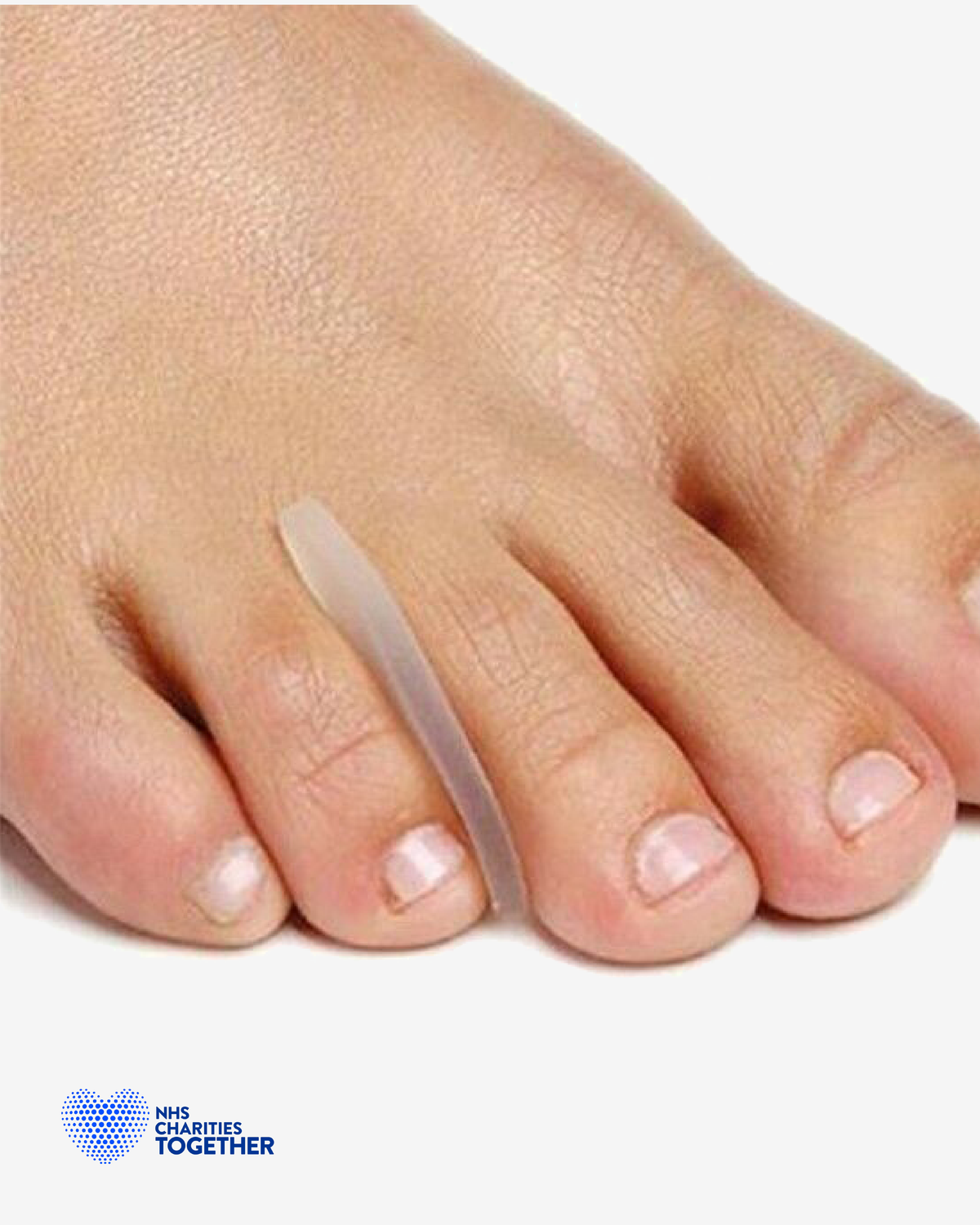Toe Separator vs Toe Spreader vs Separating Comb: What’s the Difference?