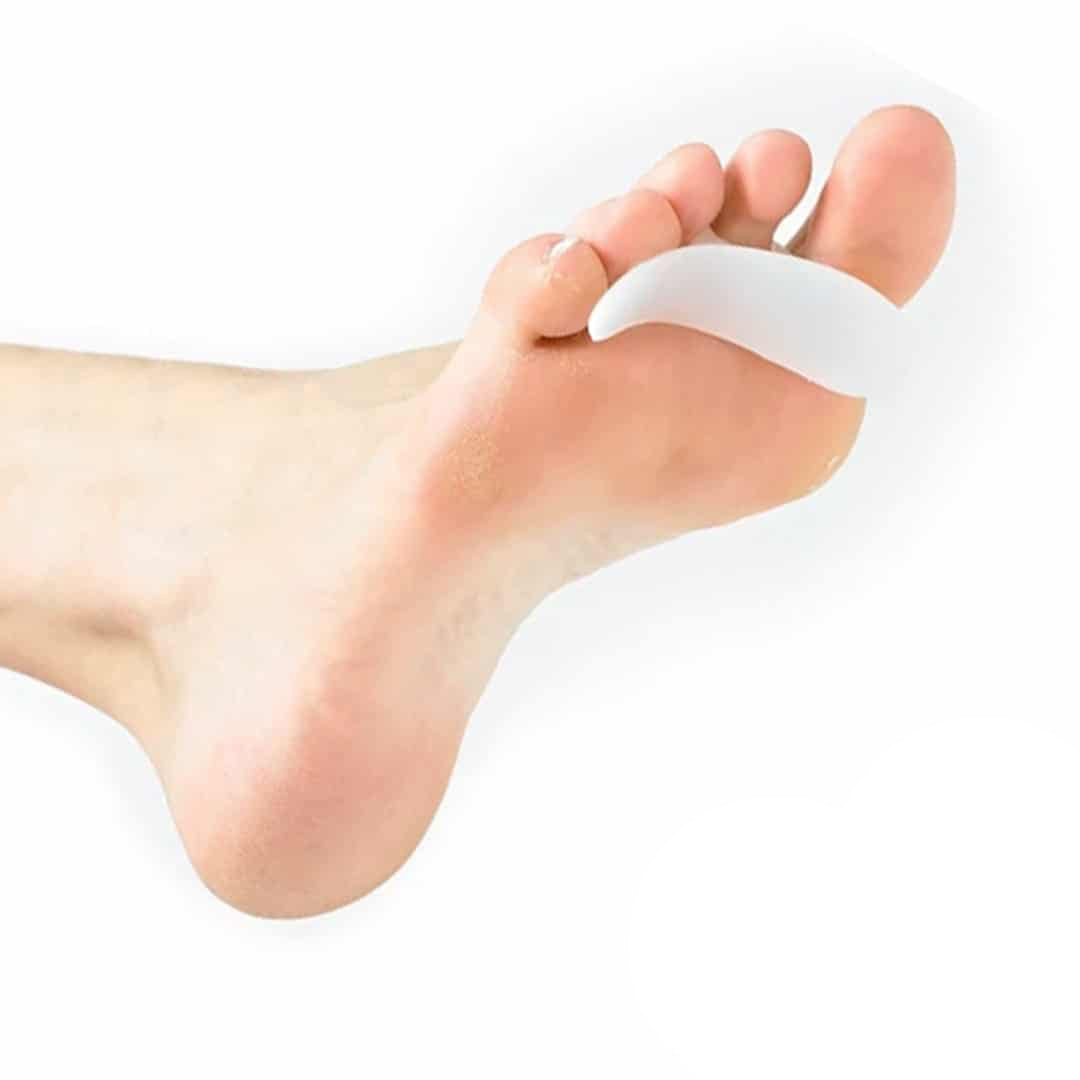 What Is a Gel Toe Crest and When Is It Used?
