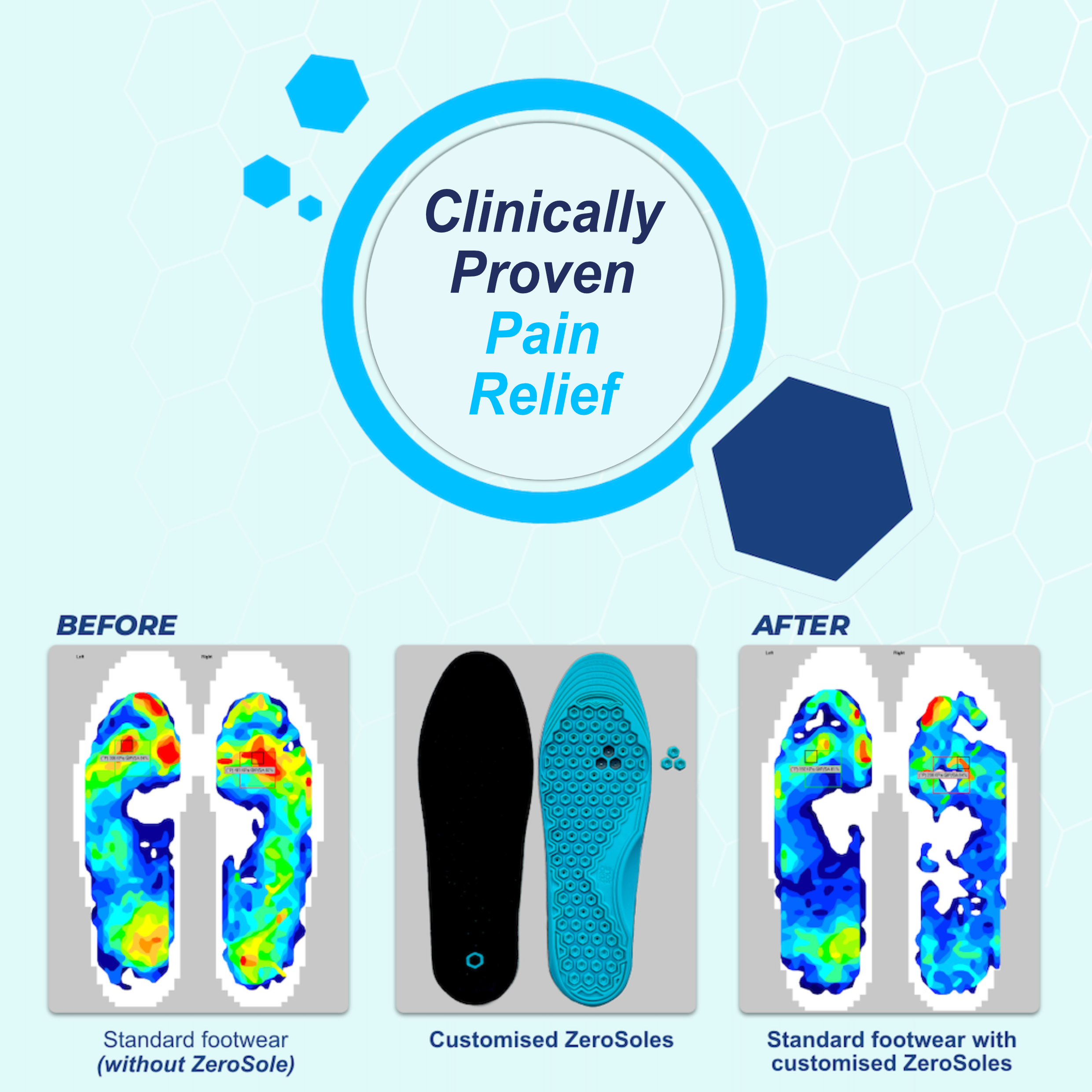 ZeroSole Reliever Gel Insole