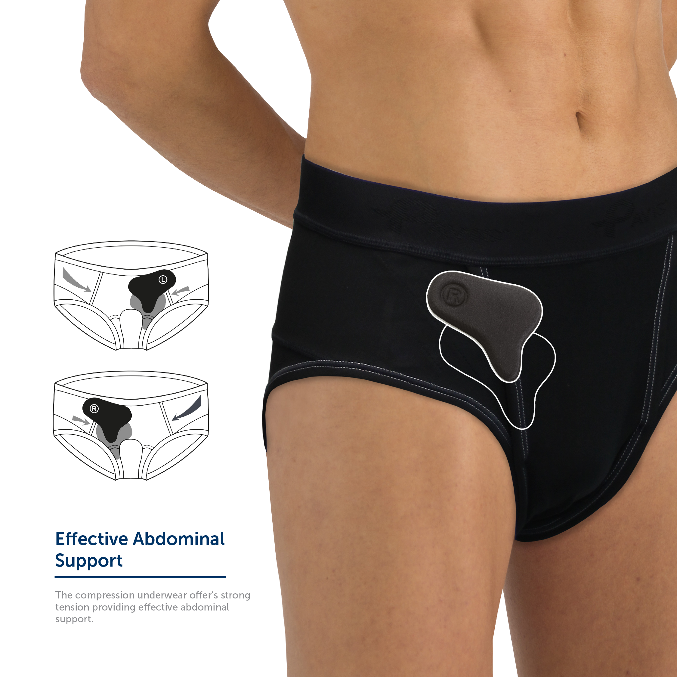 Hernia Compression Underwear & Pads - Including free hernia pads - Orthotix  UK