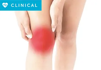 What is Patella Subluxation?