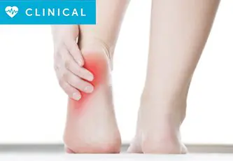 What Is Plantar Fasciitis?