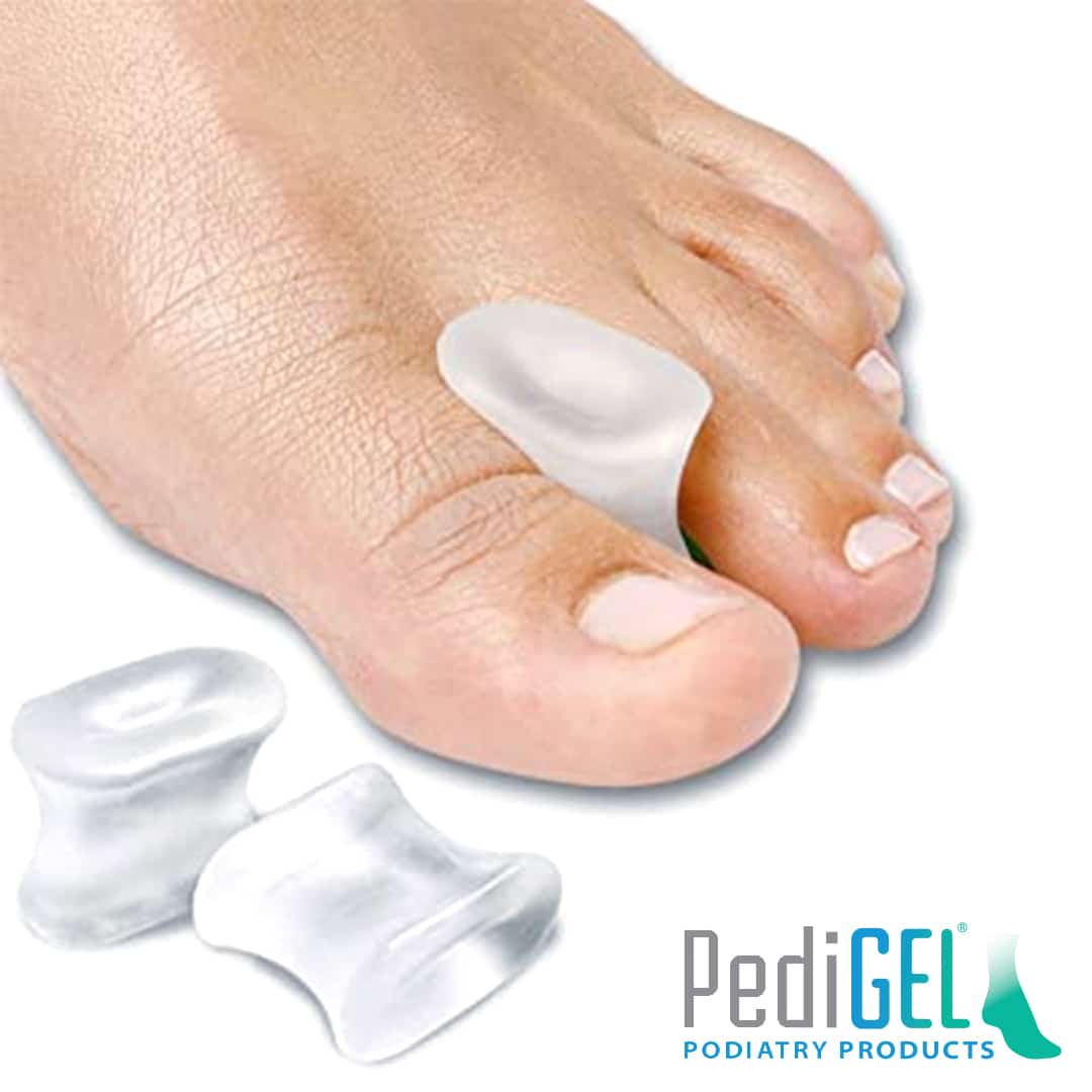 Toe 1 deals